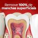 Creme Dental Clareador Colgate Luminous White Brilliant 70g - Imagem 7891024030820-5-.jpg em miniatúra